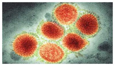 Рязанцам напомнили, как защититься от свиного гриппа