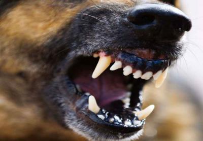 В Рязани бродячие собаки напали на ребёнка