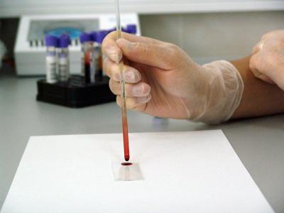 В больнице №11 Рязани появилась ПЦР-лаборатория для диагностики коронавируса