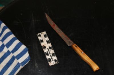 В Рязани мужчина ударил сожительницу ножом в шею и запретил обращаться за помощью