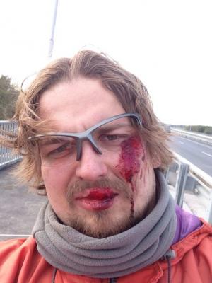 Рязанский велосипедист разбился на Северном обходе