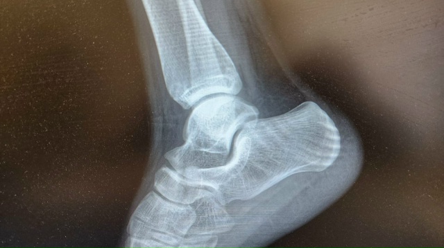 За неделю травмцентр БСМП Рязани принял почти 600 пациентов